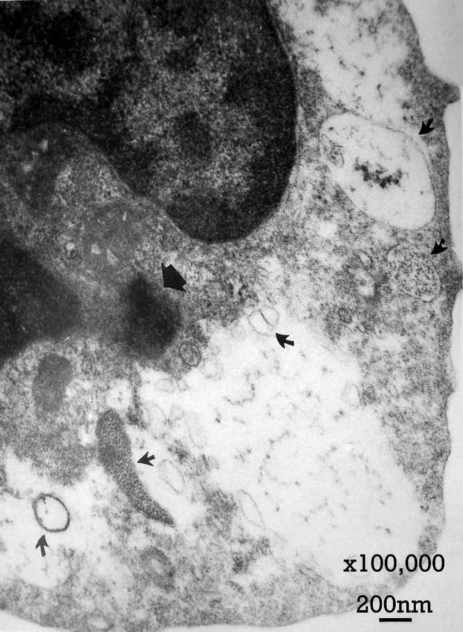 Animal Cell Electron Micrograph. Electron Micrograph taken